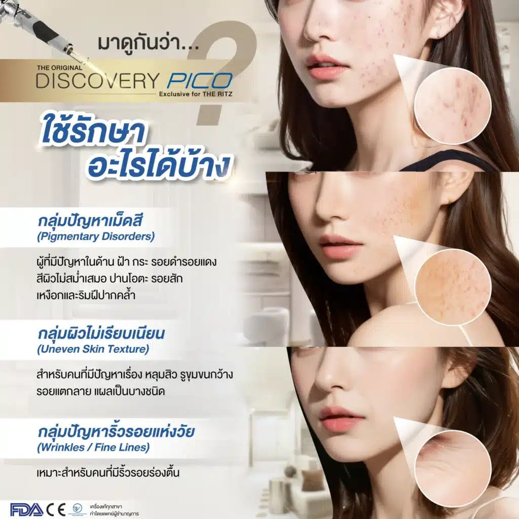 PICO รักษาอะไรได้บ้าง