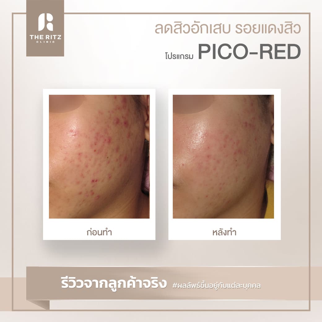 red02