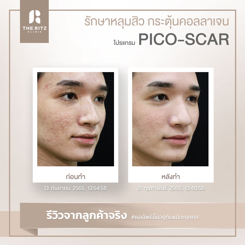 scar019