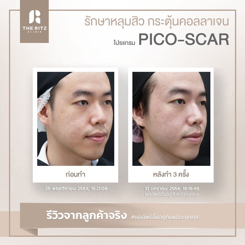 scar05