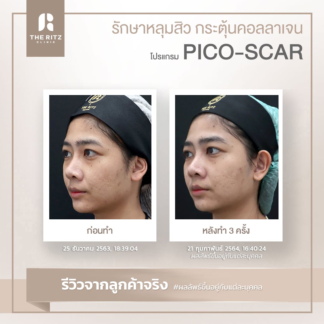 scar09