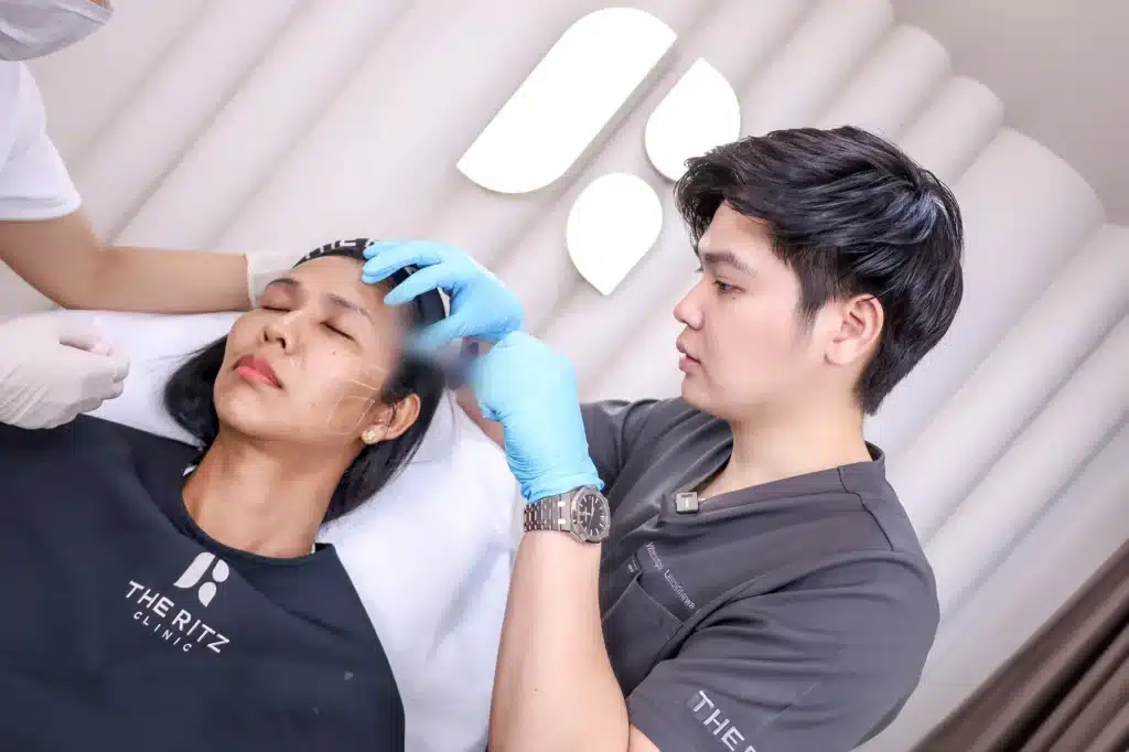 ขั้นตอนแรก การฉีดฟิลเลอร์หน้าผาก