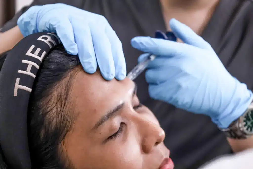 ปรับโหงวเฮ้งหน้าผากด้วยฟิลเลอร์ หน้าสวยหวาน วาสนาดี