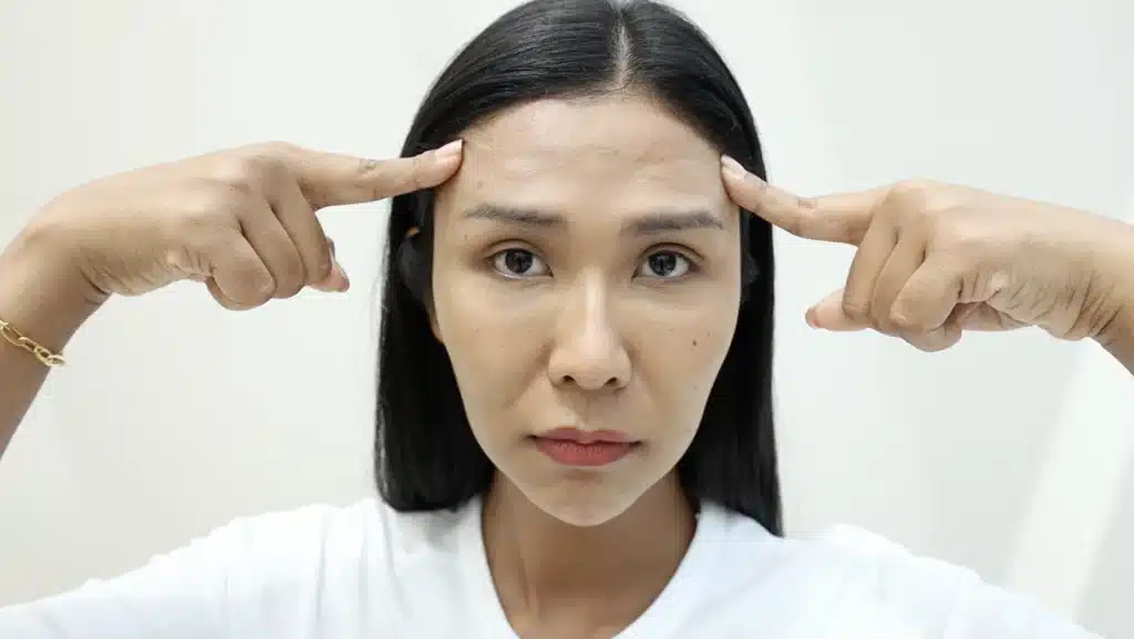 ปัญหาหน้าผากแบนและเว้าลงมากกว่าปกติ