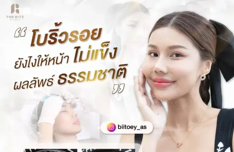 เคลียร์ชัด ฉีดโบท็อกกี่วันเห็นผล แต่ละตำแหน่งต่างกันอย่างไร