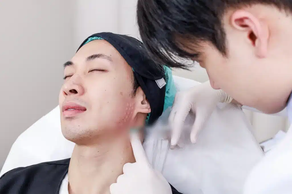 โบท็อกลิฟกรอบหน้า คืออะไร?