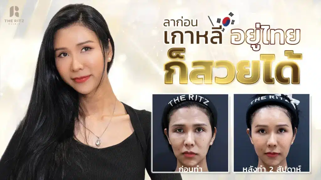 โหงวเฮ้งหน้าผากที่ดีเป็นอย่างไร?