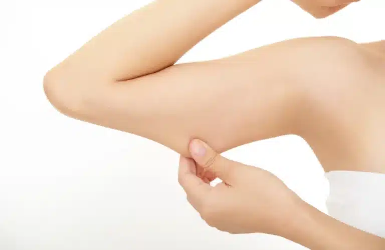 รวมเรื่องต้องรู้ที่ทำให้ต้นแขนใหญ่ เกิดจากอะไร ลดยังไงได้บ้าง