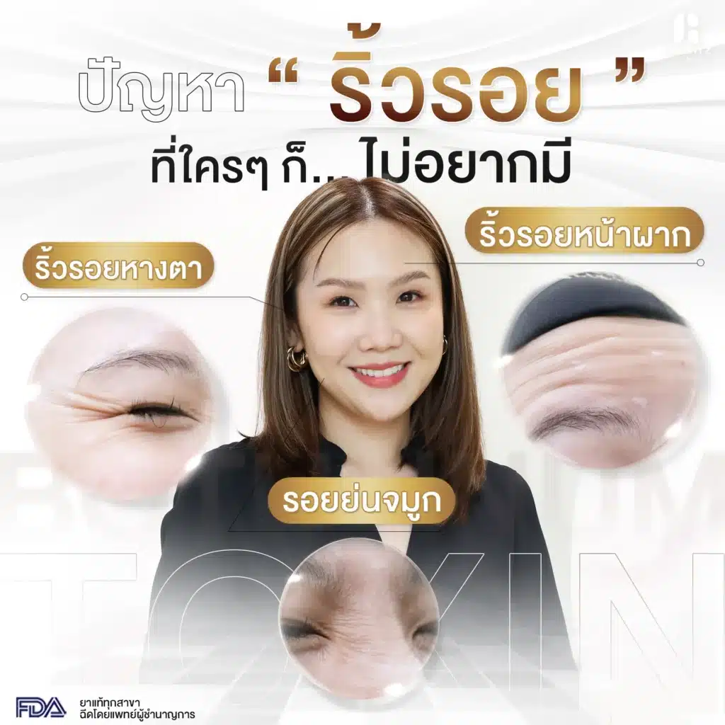 วิธีป้องกันไม่ให้เกิดรอยตีนกา