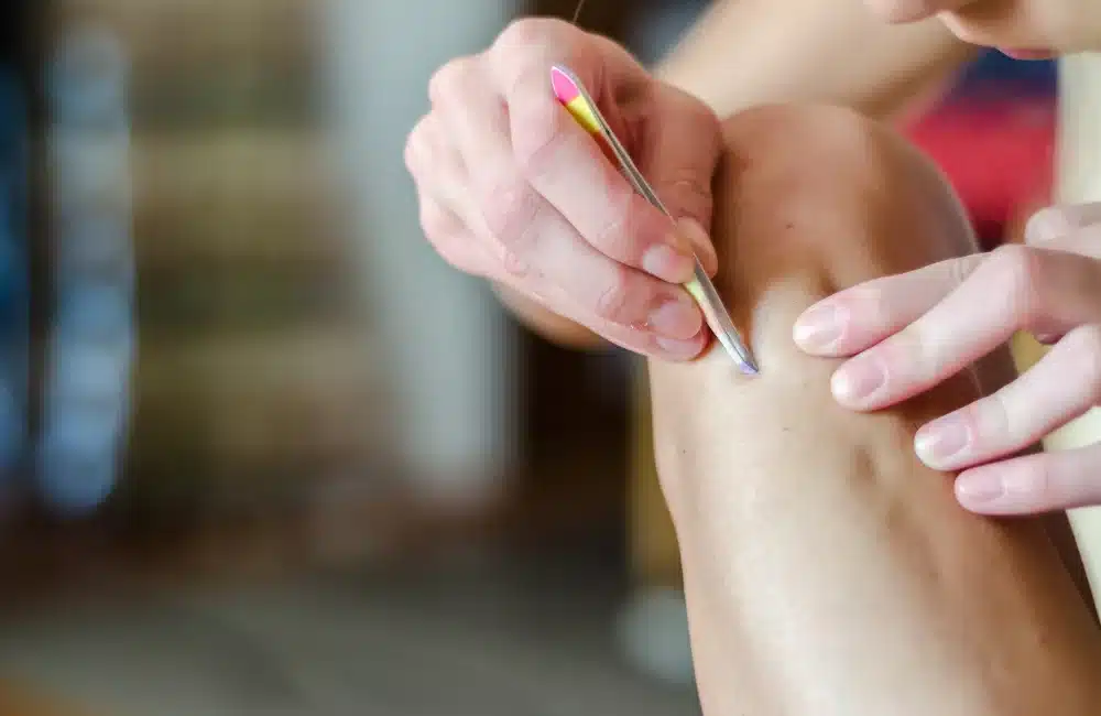 แหนบถอนขน