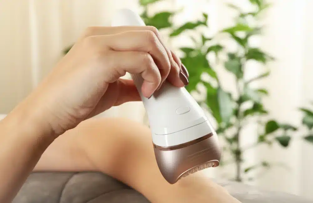 ถอนขนด้วยเครื่องไฟฟ้า