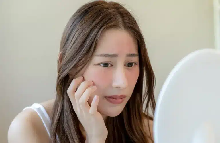 สัญญาณเตือนผิวขาดคอลลาเจน ปัญหาที่ควรระวัง