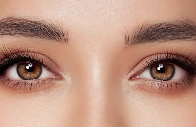 ปัญหาถุงใต้ตาใหญ่แก้ได้ด้วยวิธีใดบ้าง