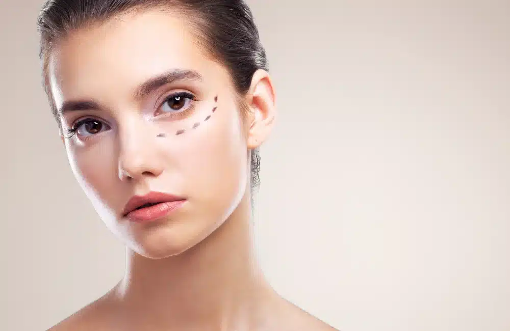 ปัญหาถุงใต้ตาใหญ่ หย่อนคล้อยเกิดจากอะไร