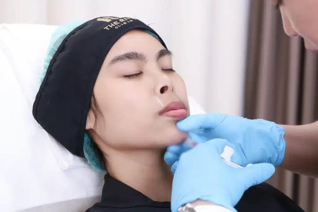 วิธีดูแลตนเองหลังฉีดฟิลเลอร์คาง