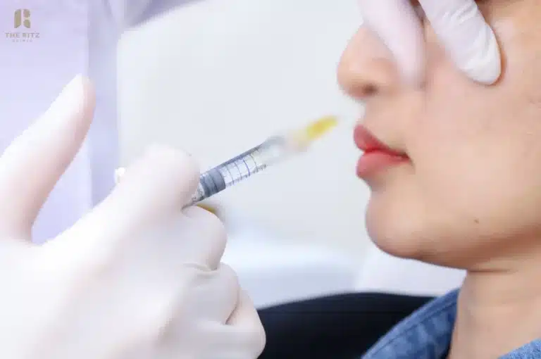 สรุปวิธีเช็คฟิลเลอร์แท้แต่ละยี่ห้อ เพื่อความสวยงามที่ปลอดภัย