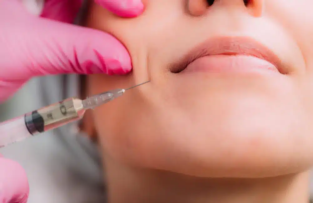 ฉีดฟิลเลอร์ร่องแก้ม ร่องน้ำหมาก