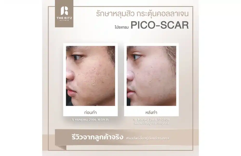 รวมภาพรีวิวจริง!