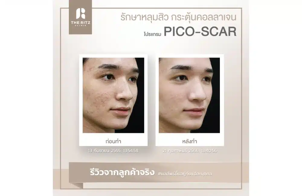 รวมภาพรีวิวจริง!