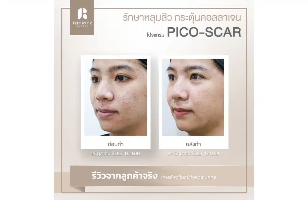 รวมภาพรีวิวจริง!