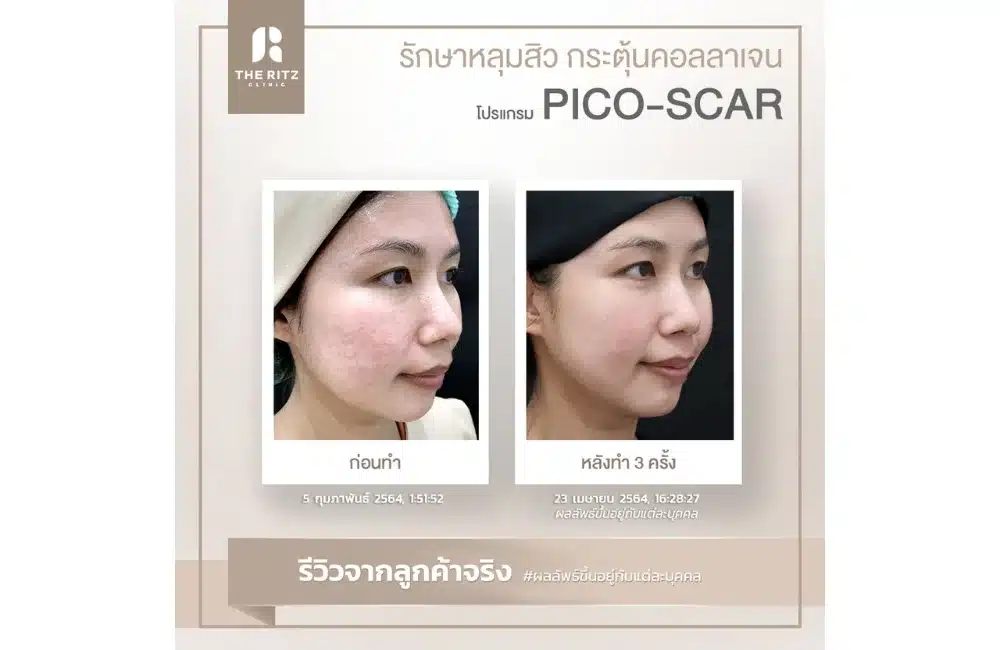 รวมภาพรีวิวจริง!