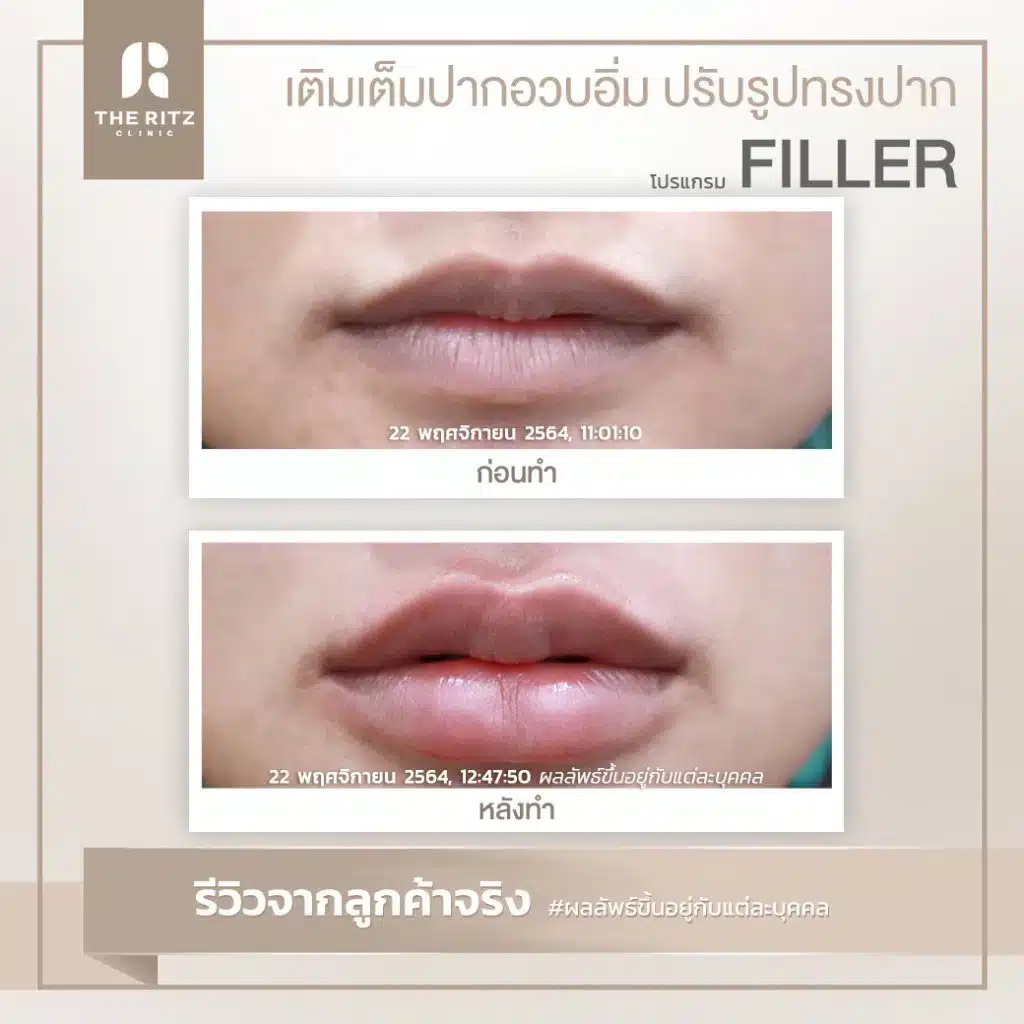 รีวิวปากกระจับเสริมโหงวเฮ้ง