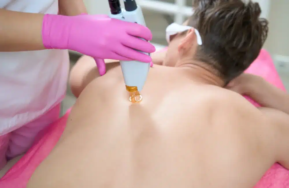 วิธีรักษาสิวที่หลัง