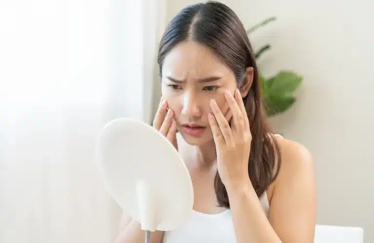 cover สิวเรื้อรัง ไม่หายสักที ต้นตอเกิดจากอะไร_ รับมืออย่างไ