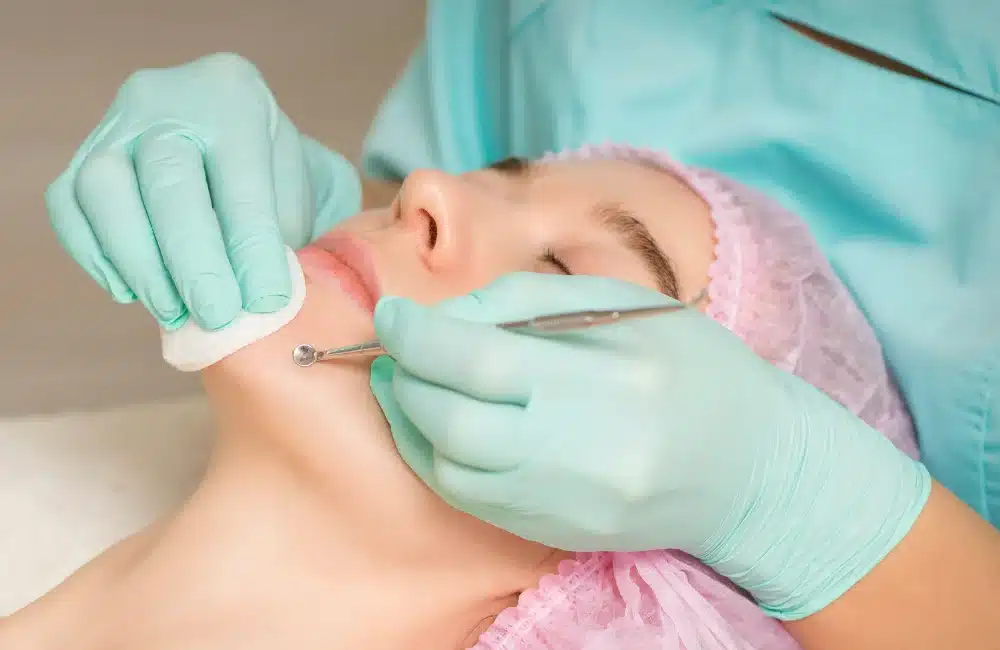 สิวเรื้อรังรักษาอย่างไรได้บ้าง