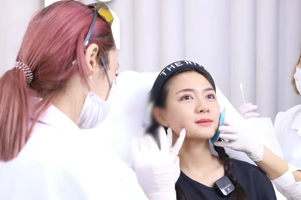 HIFU กรอบหน้า