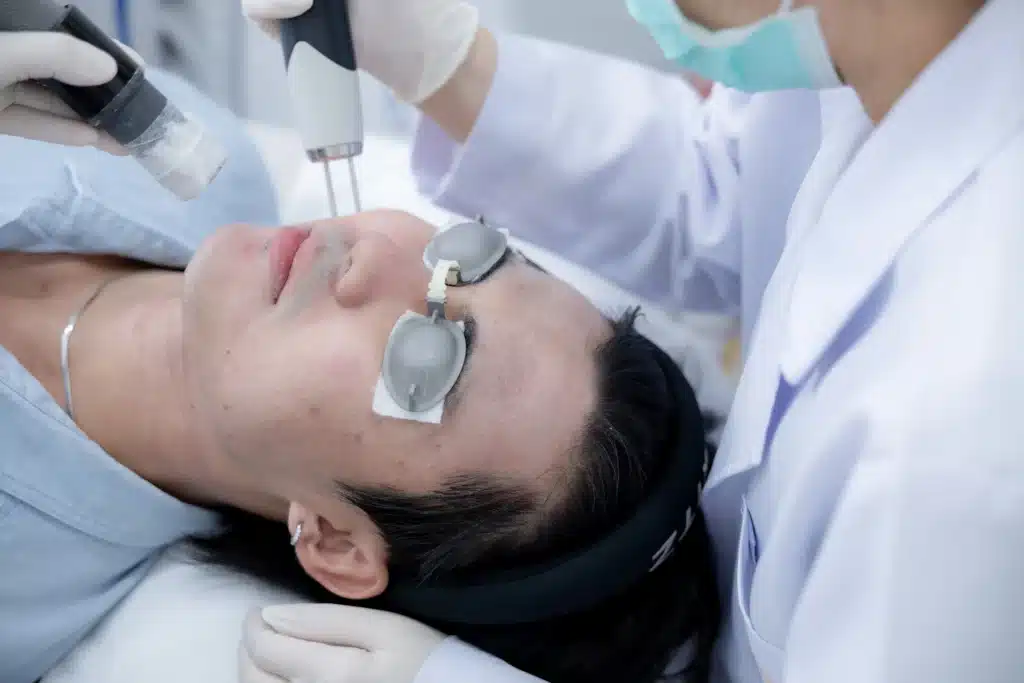 เครื่องเลเซอร์สิว มีแบบไหนบ้าง