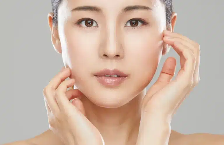 เลเซอร์ฝ้ากระ