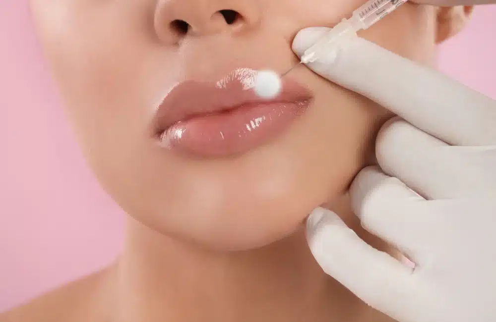 ฉีดฟิลเลอร์ปากทรงมาสด้า