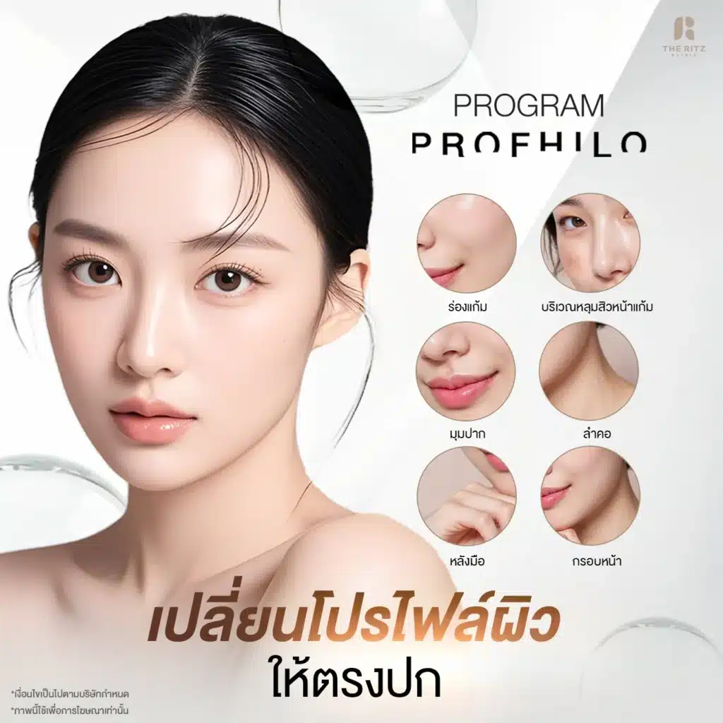 Profhilo ฉีดตรงไหนได้บ้าง