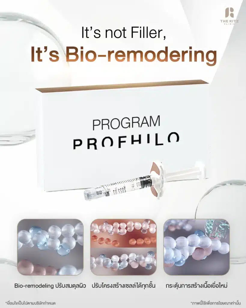 Profhilo ออกฤทธิ์อย่างไร