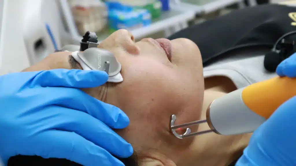 ทําไมฝ้าถึงขึ้นตรงโหนกแก้ม