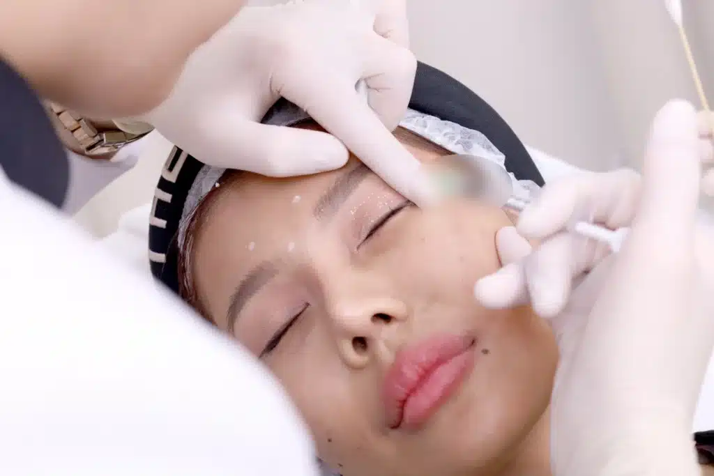 โบท็อกริ้วรอยใต้ตา