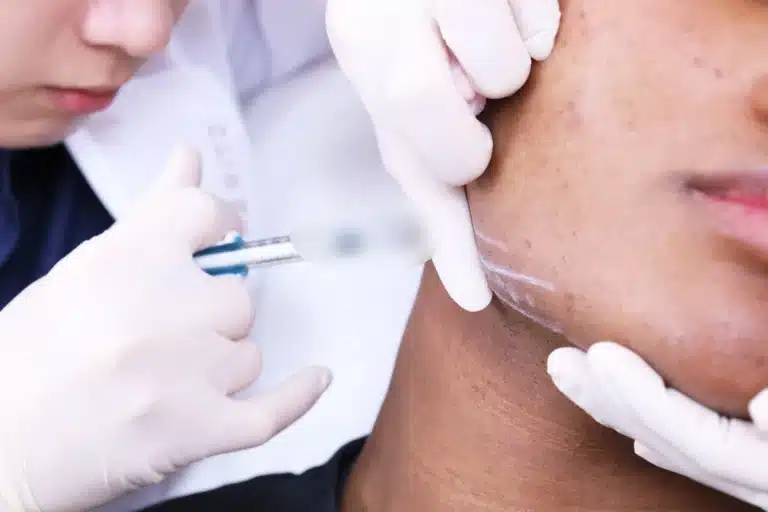 ฟิลเลอร์กรอบหน้า (Jawline Filler)