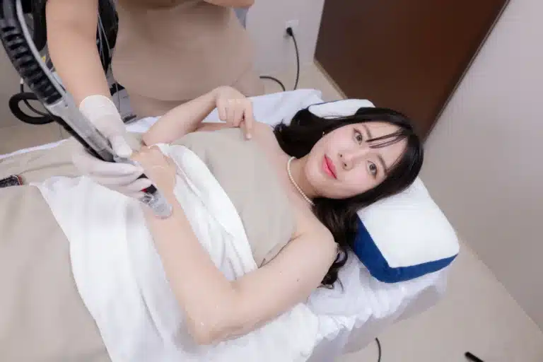 เลเซอร์ขน