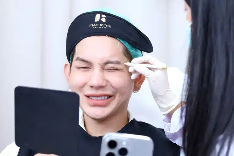 โบท็อกริ้วรอย