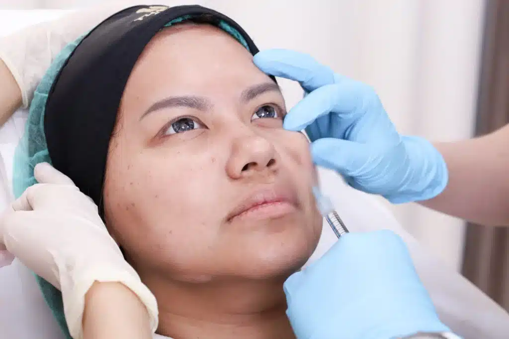 วิธีแก้ปัญหาร่องลึกใต้ตา