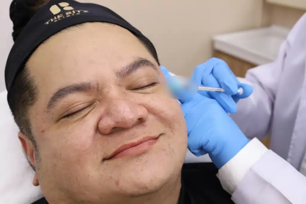 โปรแกรมโบท็อกซ์ 100 ยูนิต ฉีดอะไรได้บ้าง