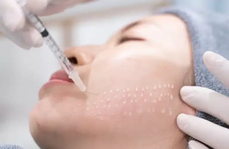 ฉีดเมโสหน้าใส คืออะไร?