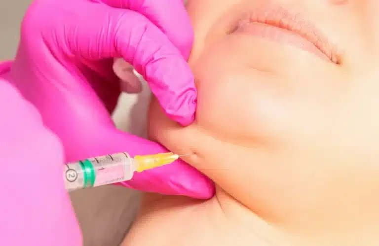 การฉีดแฟตคืออะไร ช่วยอะไรได้บ้าง