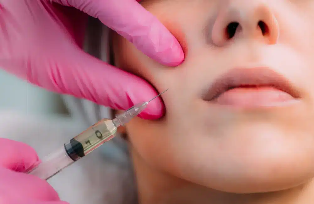 ฉีดแฟตแก้ม คืออะไร?