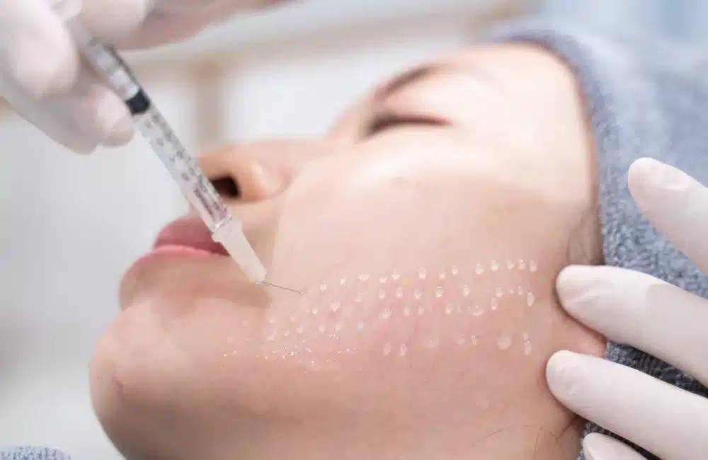 10. การฉีดเมโสลดสิวและปรับสภาพผิว