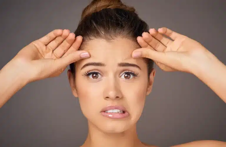 หน้าผากย่น