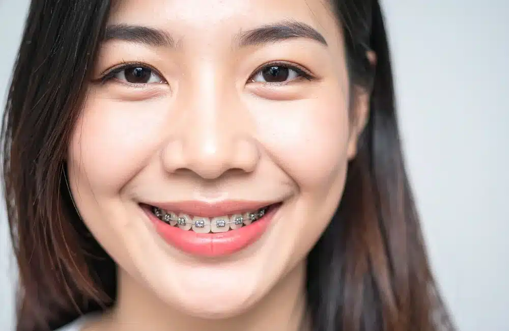 ร่องน้ำหมาก