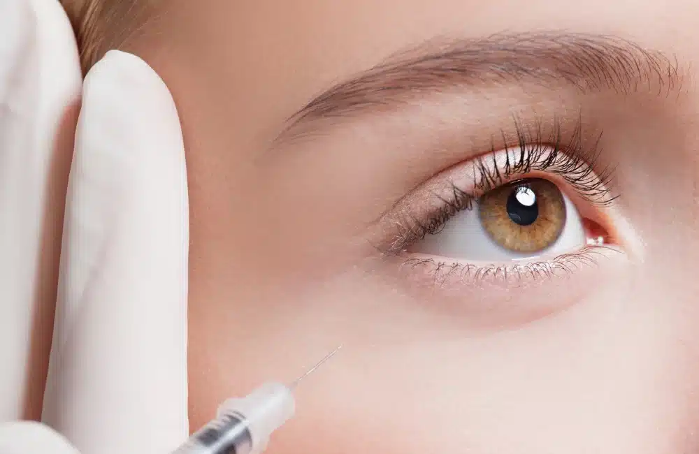 ร่องน้ำตา