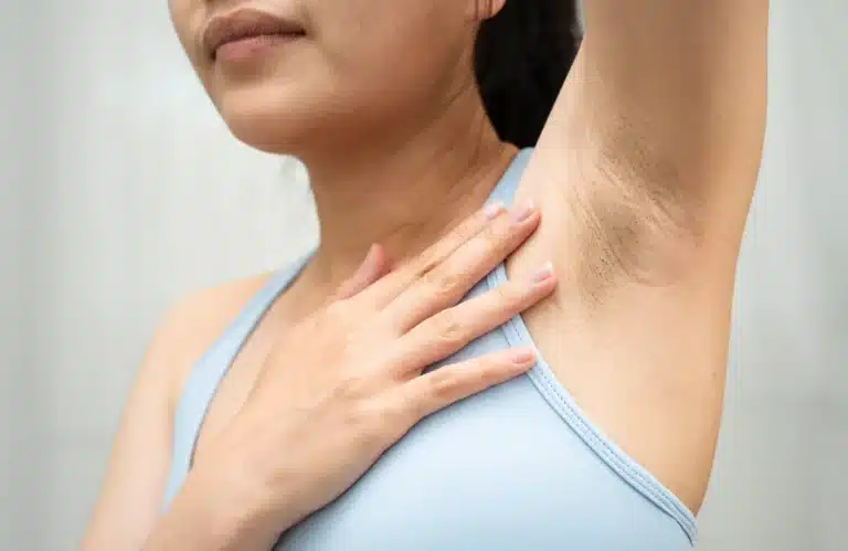 รักแร้ดำ เกิดจาก